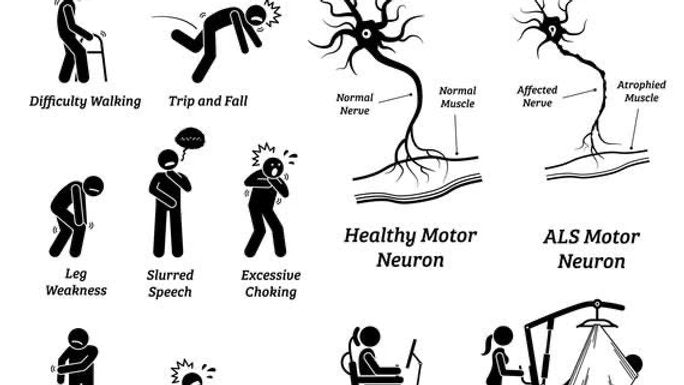 Lou Gehrig's disease /ALS, amyotrophic lateral sclerosis