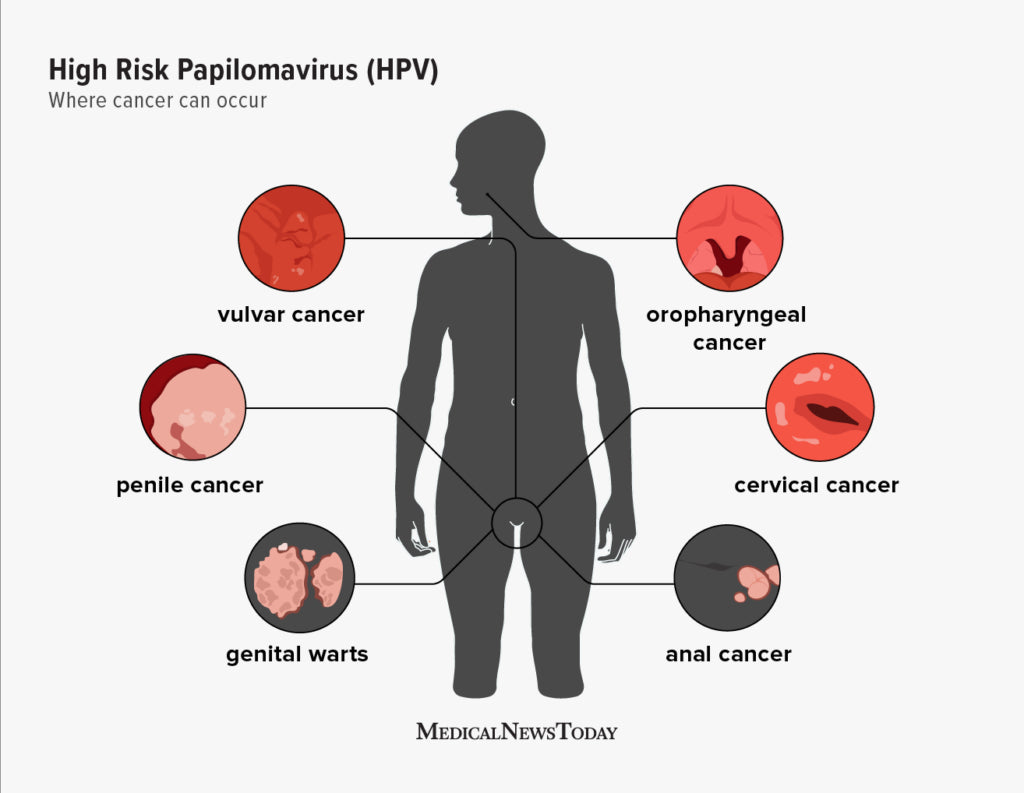Human papillomavirus (HPV)
