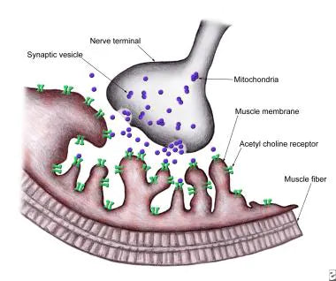 Myasthenia Gravis