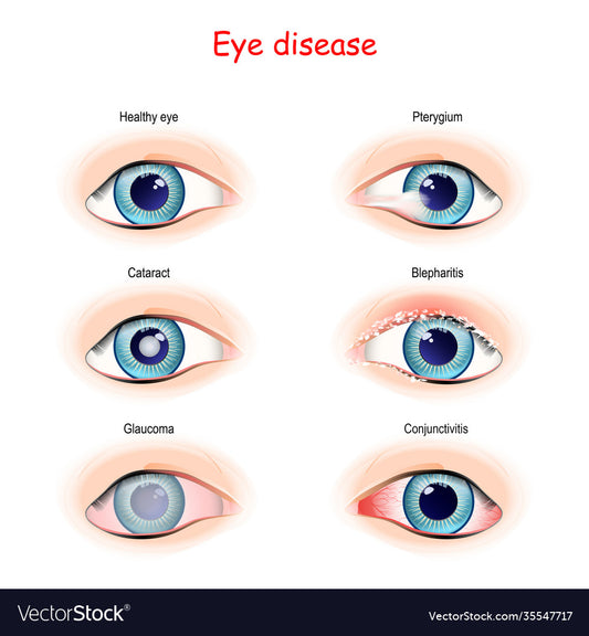 Eye Problems
